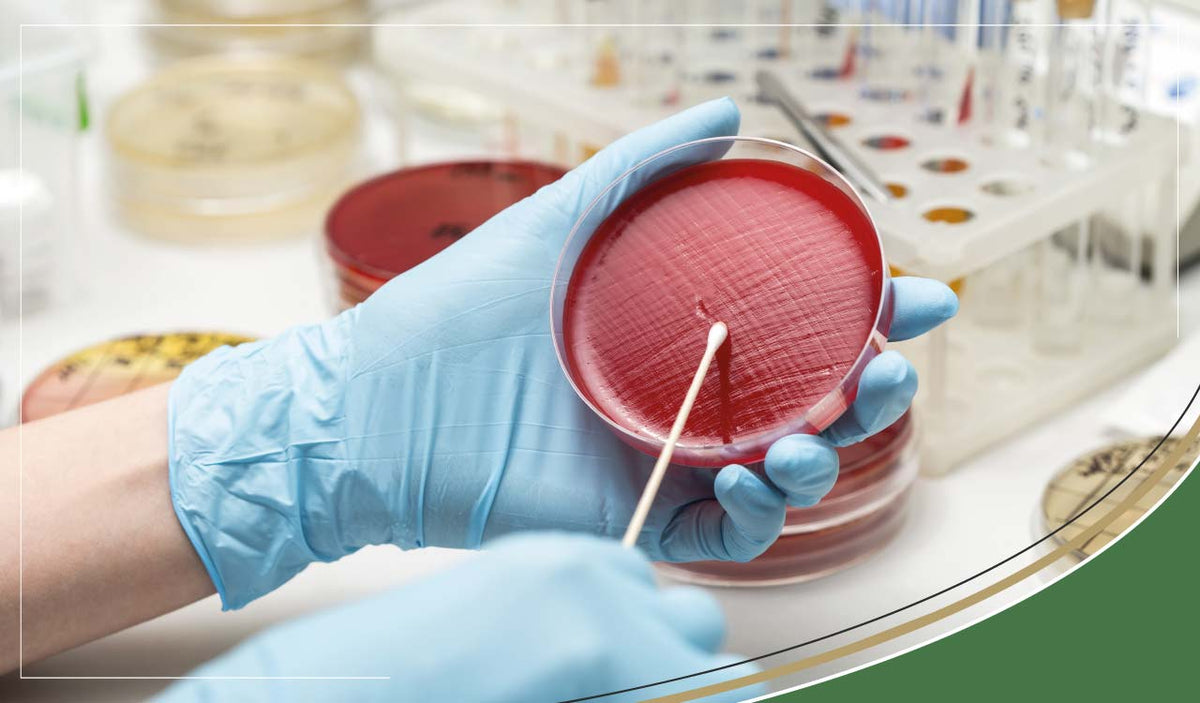 Urine Culture For Uti urine-culture-for-uti